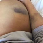 Либерж Кпадону оказалась в больнице после жестокого избиения